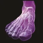 Entreprises 1 image COMFORT MOTION PODOLOGIE detailhandel in medische en orthopedische artikelen in gespecialiseerde winkels dans Lochristi VOV
